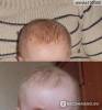 Фото 4 - Детская косметика Baby Born Эльфа Очищающее масло для удаления себорейных корочек. Фото 4