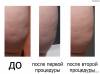 Фото 2 - Салонная процедура Lipo-Stock extreme (Липосток) от Germaine de Capuccini Фото 2